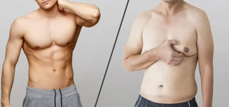 Comment perdre la graisse niveau des pectoraux en salle de sport, Échirolles, L'Appart Fitness Eybens